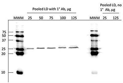 Effects of Supplemental Leucine on Growth, Nutrient Use, and Muscle and Visceral Tissue Mass in Holstein Bull Calves Fed Milk Replacer